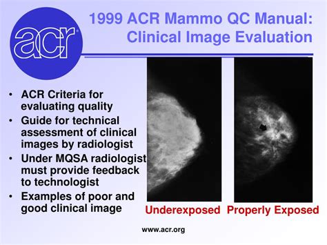 mammo qc compression test|mammography qc requirements.